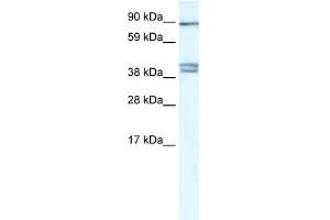 CLCNKB antibody used at 0. (CLCNKB antibody  (C-Term))