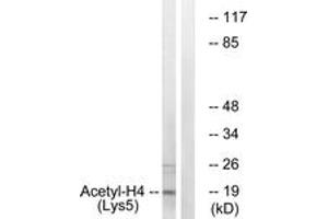Western blot analysis of extracts from COS7 cells, treated with TSA 400nM 24h, using Histone H4 (Acetyl-Lys5) Antibody. (Histone H4 antibody  (acLys5))