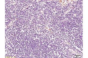 Formalin-fixed and paraffin embedded human lymph node tissue labeled with Anti-BRMS-1 Polyclonal Antibody, Unconjugated at 1:200 followed by conjugation to the secondary antibody and DAB staining