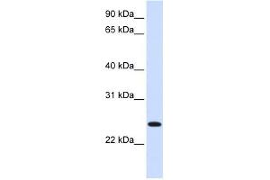 ORC6L antibody used at 1 ug/ml to detect target protein. (ORC6 antibody)