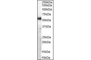 (1 µg/ml) Staining of Human Lymph Node lysate (35 µg protein in RIPA buffer). (CD14 antibody)