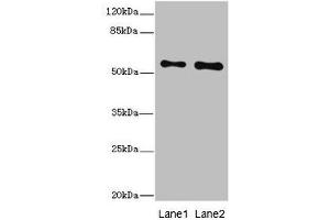 Western blot All lanes: RPS6KL1 antibody at 4.