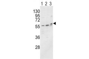 Western blot analysis of ALP / Alkaline Phosphatase antibody and MCF-7 (lane 1), HL-60 cell line (2) and mouse brain tissue (3) lysate. (ALPL antibody  (AA 3-32))