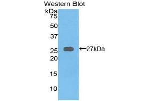Detection of Recombinant AXIN, Mouse using Polyclonal Antibody to Axis Inhibition Protein (AXIN) (Axin antibody  (AA 654-863))