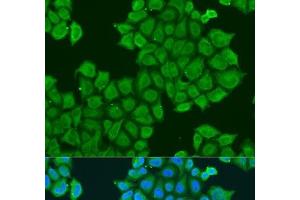 Immunofluorescence analysis of U2OS cells using STX12 Polyclonal Antibody at dilution of 1:100. (Syntaxin 12 antibody)