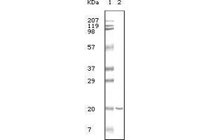 Western blot analysis using CD19 mouse mAb against CD19 recombinant protein.