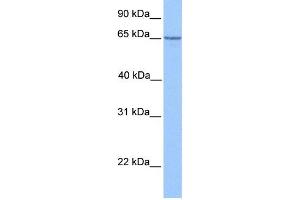 WB Suggested Anti-PML Antibody Titration:  1 ug/ml  Positive Control:  Hela cell lysate (PML antibody  (C-Term))