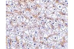 Immunohistochemistry of Fn14 in human liver tissue with Fn14 antibody at 2. (TNFRSF12A antibody)