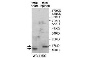 Western Blot analysis of fetal heart and fetal spleen Lysate with anti-ANAPC16 antibody.