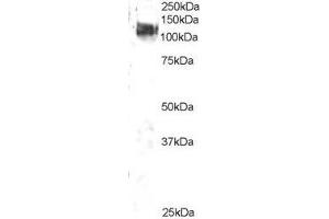 ABIN2561614 staining (2µg/ml) of 3T3 lysate (RIPA buffer, 35µg total protein per lane). (CBL antibody  (C-Term))