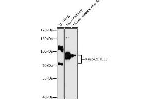 Western blot analysis of extracts of various cell lines, using Kaiso/Kaiso/ZBTB33 antibody  at 1:3000 dilution. (ZBTB33 antibody  (AA 523-672))