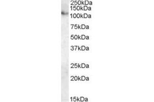 ATP13A1 antibody  (Internal Region)