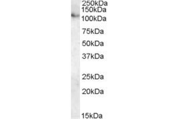 ATP13A1 antibody  (Internal Region)