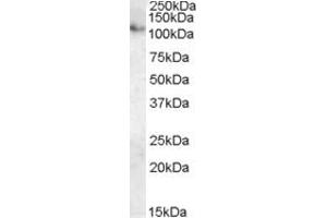 ABIN238640 (0. (ATP13A1 antibody  (Internal Region))