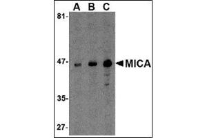 Western blot analysis of MICA in A-20 cell lysate with this product at (A) 0. (MICA antibody  (C-Term))