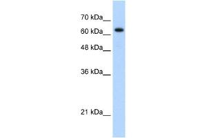 WB Suggested Anti-RAD17 Antibody Titration: 1. (RAD17 antibody  (C-Term))