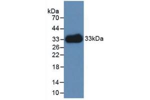 Western blot analysis of recombinant Human LAMC1. (Laminin gamma 1 antibody  (AA 521-772))