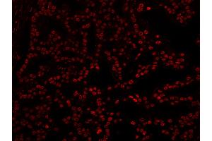 Immunofluorescence (IF) image for anti-5'-3' Exoribonuclease 2 (XRN2) (AA 900-950) antibody (ABIN7449038)