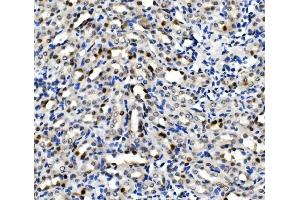 IHC analysis of MCM5 using anti-MCM5 antibody (ABIN7600582).