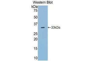 Western Blotting (WB) image for anti-Toll-Like Receptor 5 (TLR5) (AA 303-514) antibody (ABIN1860772) (TLR5 antibody  (AA 303-514))