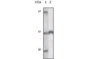 Western Blot showing TYRO3 antibody used against truncated TYRO3 recombinant protein.