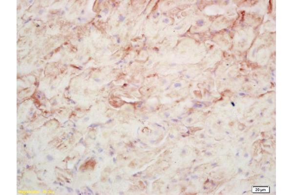 AMPD1 antibody  (AA 101-200)