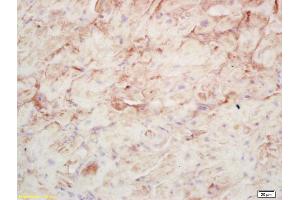 Formalin-fixed and paraffin embedded rat cardiac muscle labeled with Rabbit Anti AMP deaminase 1 Polyclonal Antibody, Unconjugated (ABIN873205) at 1:200 followed by conjugation to the secondary antibody and DAB staining (AMPD1 antibody  (AA 101-200))