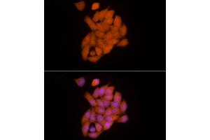 Immunofluorescence analysis of HeLa cells using Ube2L3 / UBCH7 Rabbit mAb (ABIN7271178) at dilution of 1:25 (40x lens). (UBE2L3 antibody)