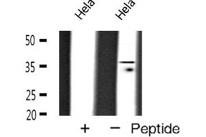 Western blot analysis of TBP expression in Hela cells (TBP antibody  (N-Term))