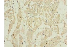 Immunohistochemistry of paraffin-embedded human heart tissue using ABIN7155653 at dilution of 1:100