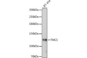Western blot analysis of extracts of BT-474 cells, using TMC5 antibody (ABIN7270941) at 1:1000 dilution. (Tmc5 antibody  (AA 676-760))
