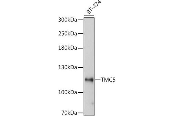 Tmc5 Antikörper  (AA 676-760)