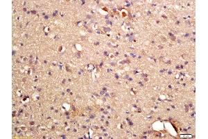 Formalin-fixed and paraffin embedded rat brain labeled with Rabbit Anti-phospho-GRLF1(Tyr1087) Polyclonal Antibody, Unconjugated (ABIN2174954) at 1:200 followed by conjugation to the secondary antibody and DAB staining
