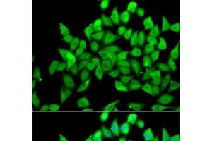 Immunofluorescence analysis of A549 cells using ALS2 Polyclonal Antibody (ALS2 antibody)