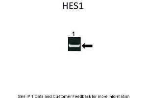 Immunoprecipitation (IP) image for anti-Hes Family bHLH Transcription Factor 1 (HES1) (N-Term) antibody (ABIN2779597)