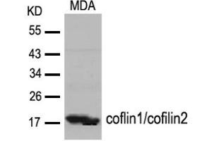 Image no. 2 for anti-Cofilin 1 (CFL1) (Tyr88) antibody (ABIN319381) (Cofilin antibody  (Tyr88))