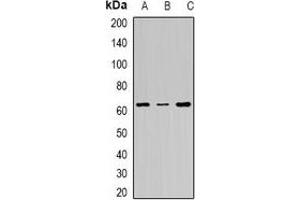 Western blot analysis of FANCC expression in Jurkat (A), Hela (B), mouse intestin (C) whole cell lysates. (FANCC antibody)
