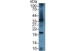 Detection of LAB7-1 in Mouse Spleen lysate using Polyclonal Antibody to B-Lymphocyte Activation Antigen B7-1 (LAB7-1) (CD80 antibody  (AA 38-246))