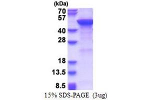 Mannosyl (Alpha-1,6-)-Glycoprotein beta-1,2-N-Acetylglucosaminyltransferase (MGAT2) (AA 30-447) protein (His tag)