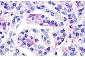 Image no. 1 for anti-G Protein-Coupled Receptor 119 (GPR119) (Cytoplasmic Domain) antibody (ABIN1048700) (G Protein-Coupled Receptor 119 antibody  (Cytoplasmic Domain))