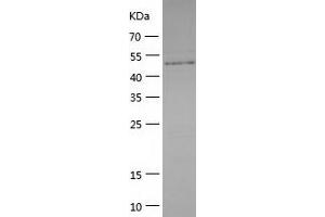 Western Blotting (WB) image for Caspase Recruitment Domain Family, Member 14 (CARD14) (AA 2-434) protein (His tag) (ABIN7288656) (CARD14 Protein (AA 2-434) (His tag))