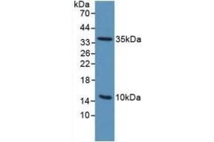 Detection of uPAR in Mouse Sp2/0 Cells using Polyclonal Antibody to Plasminogen Activator, Urokinase Receptor (uPAR) (PLAUR antibody  (AA 13-114))