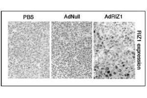 Image no. 2 for anti-PR Domain Containing 2, with ZNF Domain (PRDM2) (AA 245-573) antibody (ABIN356710)