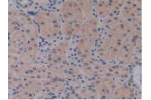 IHC-P analysis of Rat Kidney Tissue, with DAB staining.