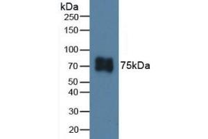 Detection of ITGb6 in Porcine Skin Tissue using Polyclonal Antibody to Integrin Beta 6 (ITGb6)
