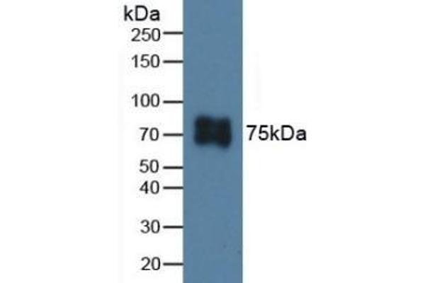 ITGB6 抗体  (AA 131-371)