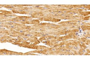 Detection of VEGFA in Rat Cardiac Muscle Tissue using Monoclonal Antibody to Vascular Endothelial Growth Factor A (VEGFA) (VEGFA antibody  (AA 27-214))