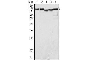 Western Blot showing LSD1 antibody used against COS (1), Hela (2), NIH/3T3 (3), A549 (4) and Jurkat (5) cell lysate.
