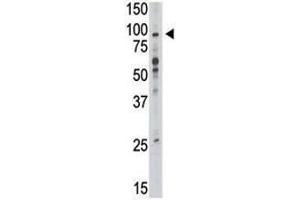 Western blot analysis of TLR6 antibody and mouse liver tissue lysate (TLR6 antibody  (AA 393-423))