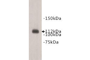 Western Blotting (WB) image for anti-Transmembrane Protein 67 (TMEM67) antibody (ABIN1854943) (TMEM67 antibody)